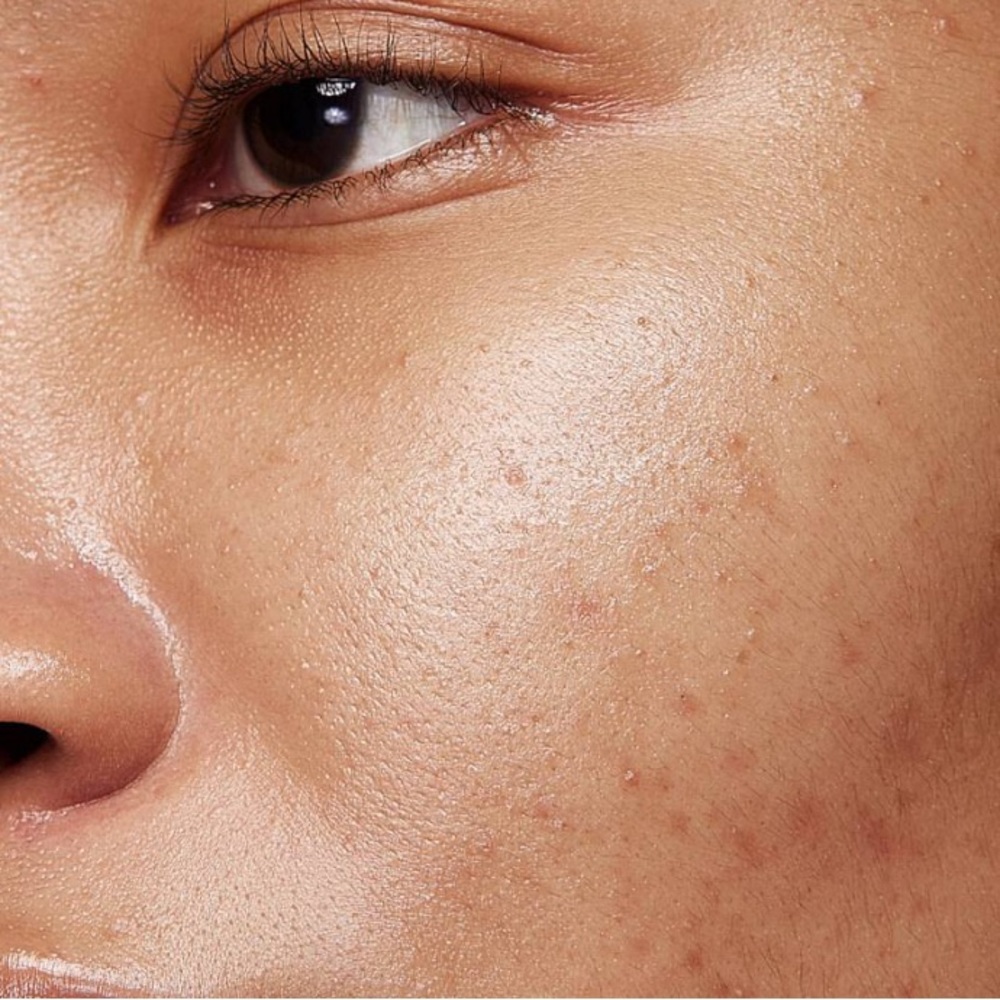 Allies Of Skin Promise Keeper Nightly Blemish Treatment - Picture 8 of 9
